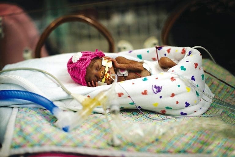 A tiny premature baby in a pink knit hat rests in a NICU incubator, with feeding tubes and monitor wires attached.