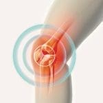 Knee painful - skeleton x-ray, 3D Illustration medical concept.
